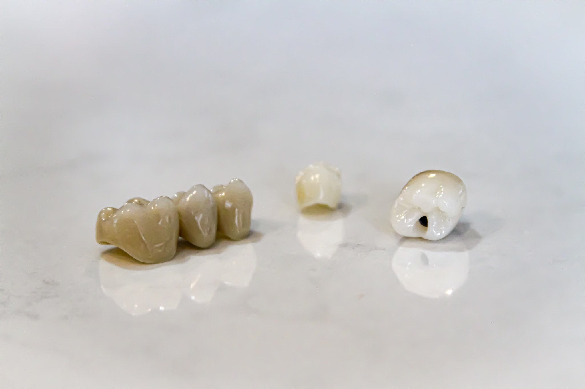 Zirconia crowns and bridges by Unident Art Dental Lab